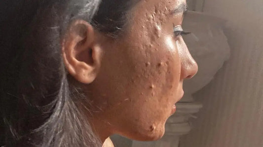 Living hell for 'forgotten' skin patients