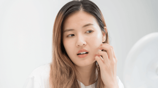 Natural Skincare for Oily Skin