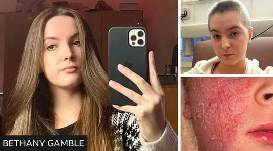 TSW Sufferer Bethany Gamble as featured in the BBC News article published 29th March 2026